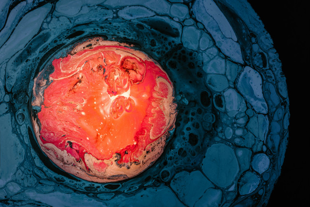 Photo by Pawel Czerwinski on Unsplash.